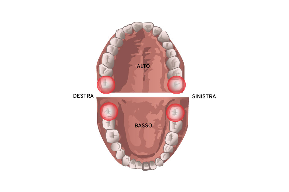 dente del giudizio